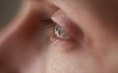 Ojos tristes después de blefaroplastia: causas y soluciones