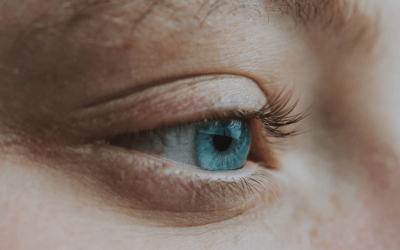 Pterigion en el ojo: guia completa sobre causas, síntomas, tratamientos y prevención