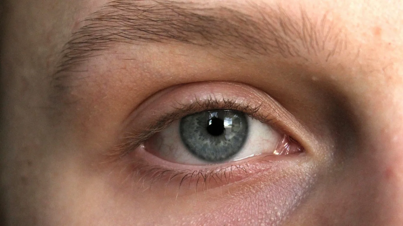 Meibomitis
