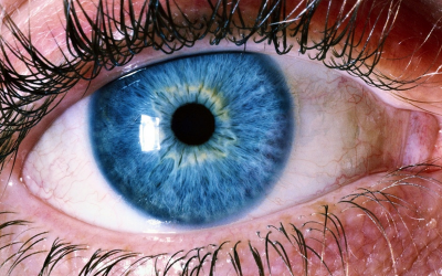 ¿Sabías que tus ojos también se pueden quemar?: Qué es la Fotoqueratitis y cómo prevenirla