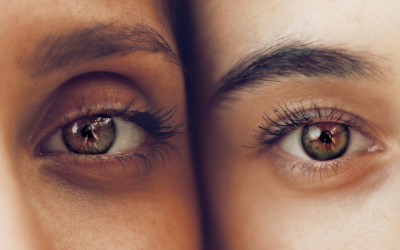 Blefaritis: Cómo identificarla y controlarla para proteger tus ojos