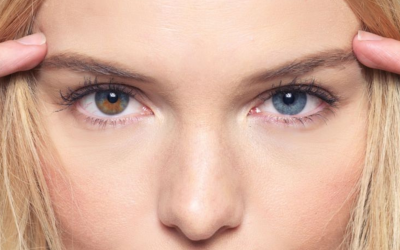 Ojos de distintos colores: descubre por qué sucede y curiosidades que te sorprenderán