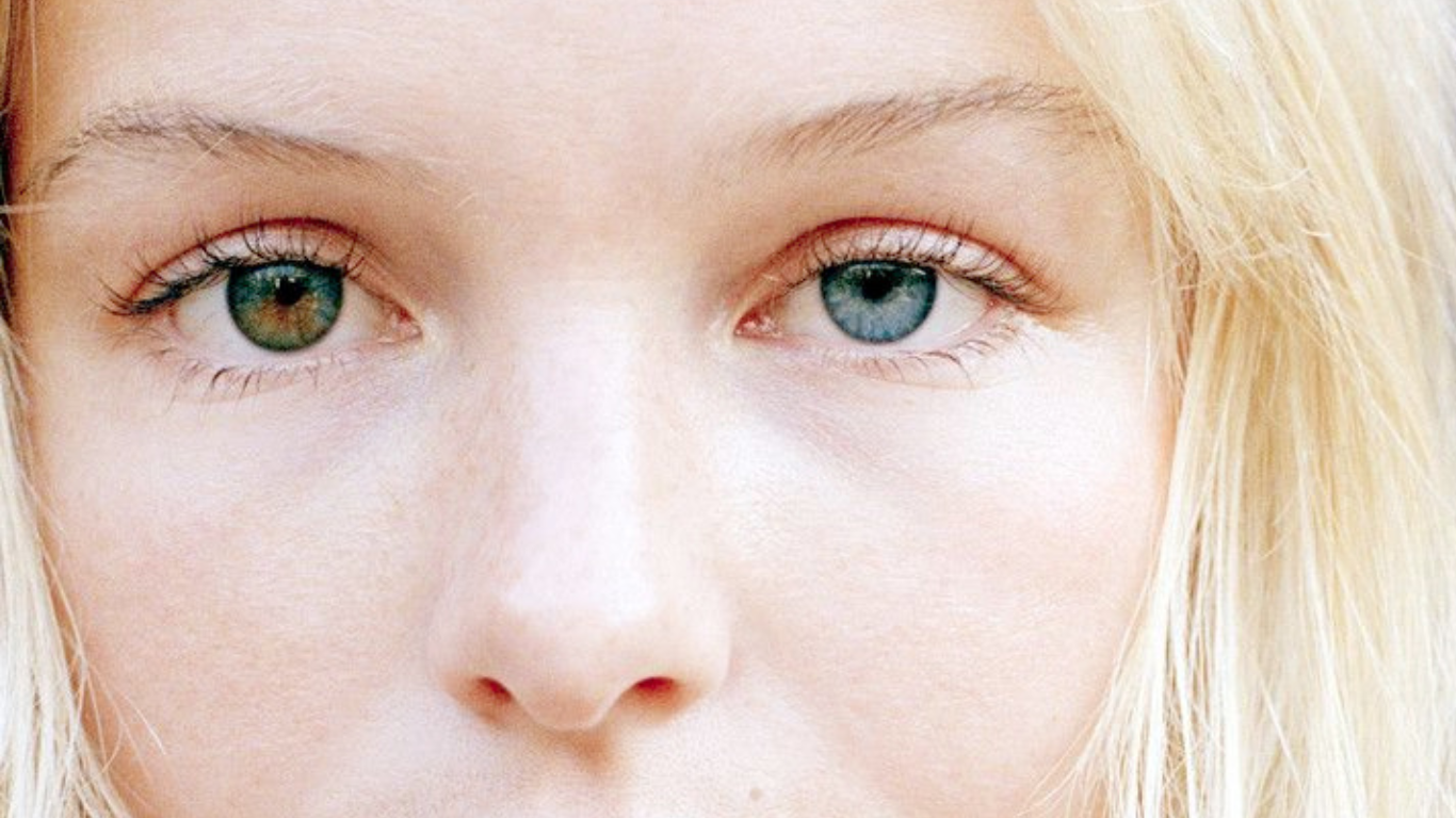 Ojos de distintos colores