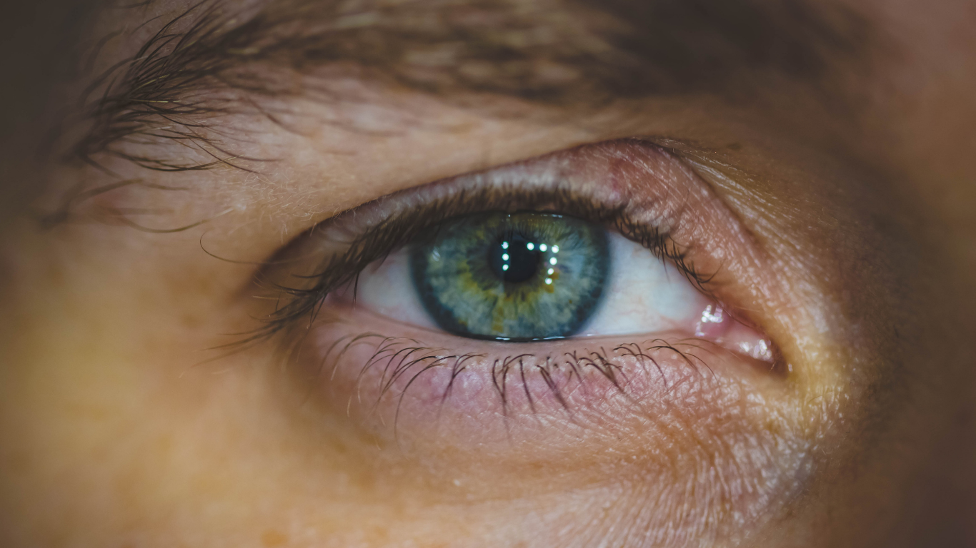 Lagañas en los ojos