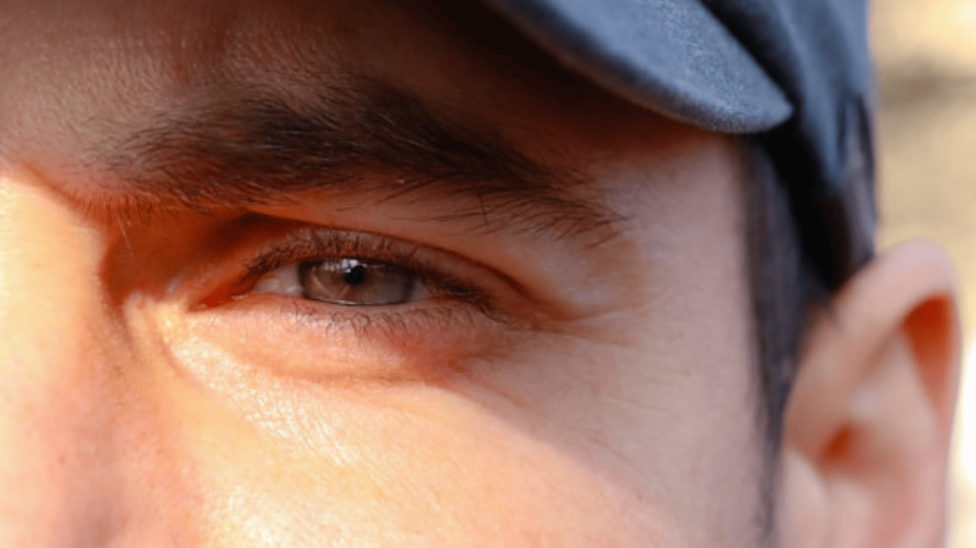 Fotoprotección Ocular