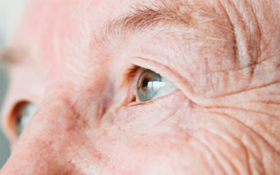 Catarata incipiente: qué es, cómo detectarla y cómo se aborda en las primeras fases