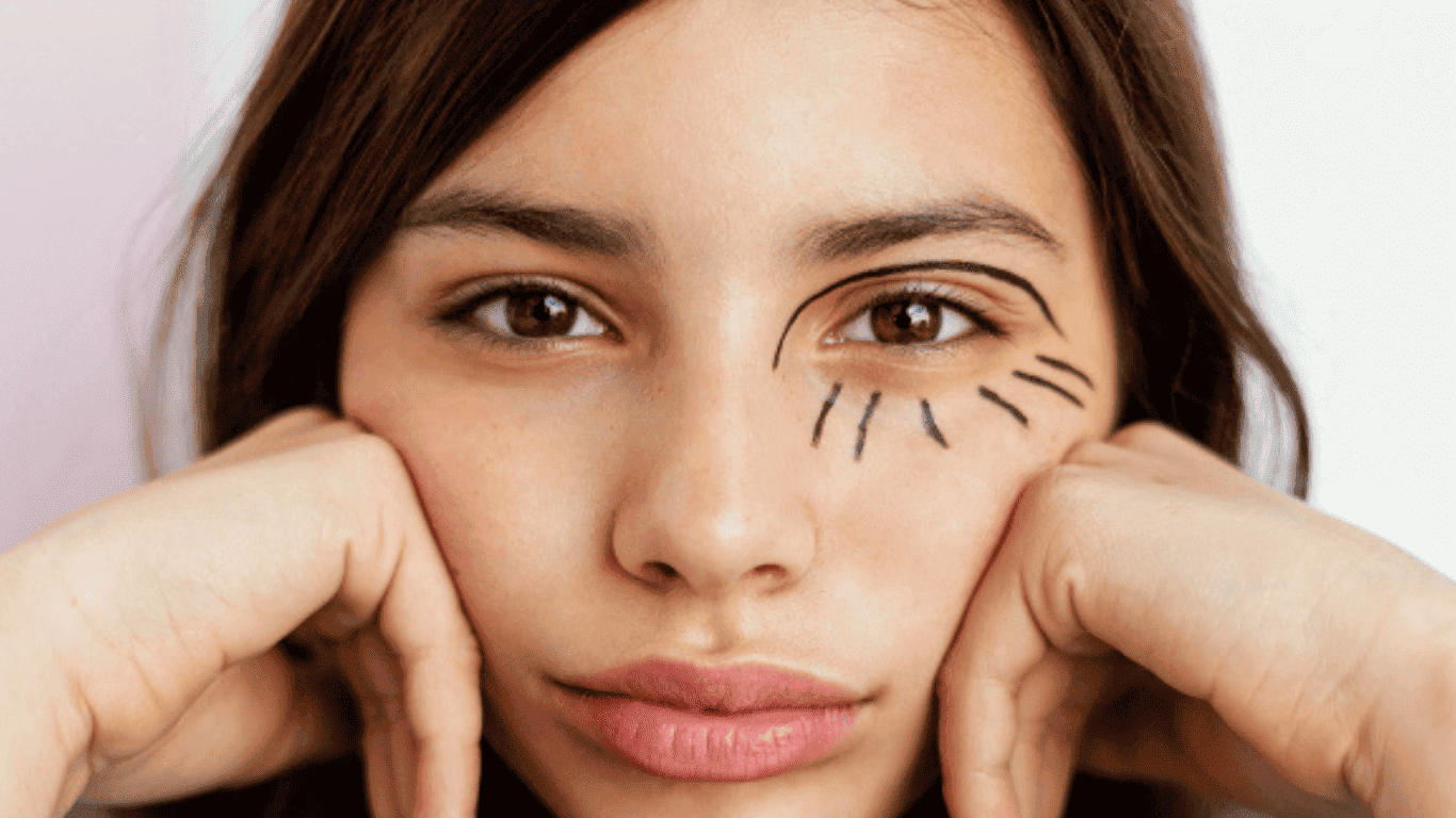¿A qué edad se recomienda una blefaroplastia?
