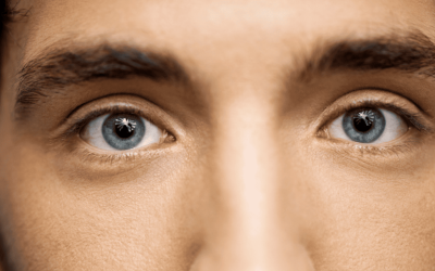 Parálisis del tercer par craneal: causas, síntomas, diagnóstico y tratamiento en neurología clínica