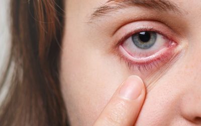 Queratitis neurotrófica: ¿qué es y cómo afecta a mi ojo?