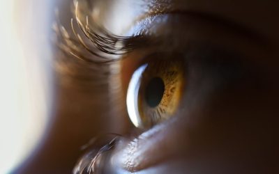 Qué es el Síndrome de Stevens-Johnson ocular