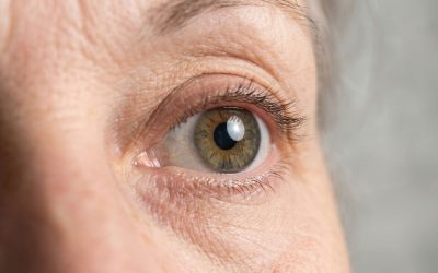 Leucocoria: qué es, síntomas, causas y tratamiento