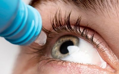 Toxicidad por colirios: causas, síntomas y tratamiento