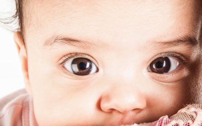 Estrabismo en niños: la importancia de una detección precoz